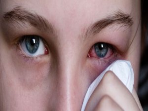 Kırmızı göz hastalığına dikkat