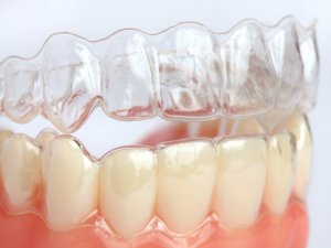 Tel takmak istemeyenlere müjde