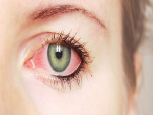 Bugünlerde gözlere dikkat