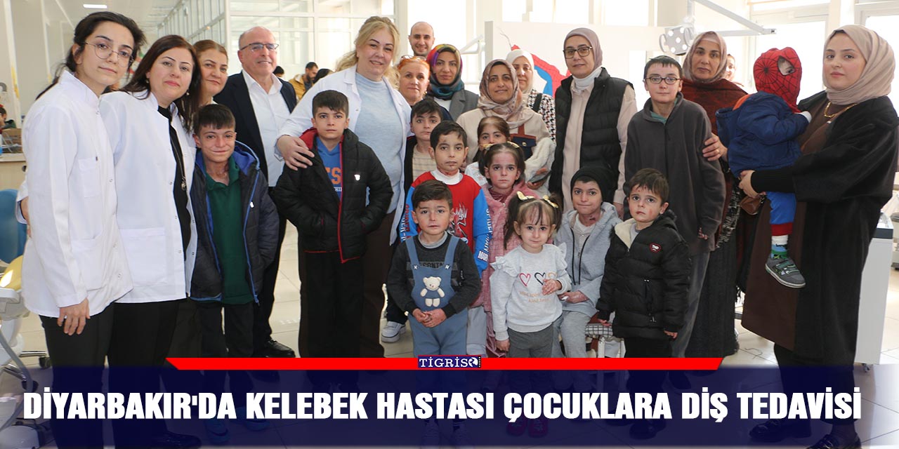 Diyarbakır'da kelebek hastası çocuklara diş tedavisi