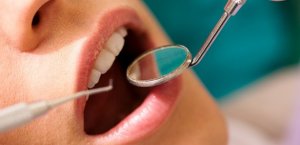 Diş hekimine düzenli sıklıklarla gidilmeli