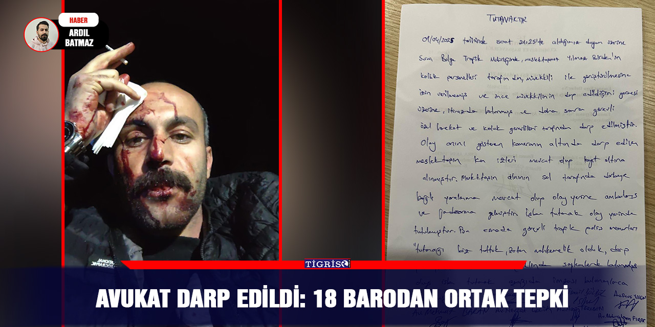 Avukat darp edildi: 18 barodan ortak tepki