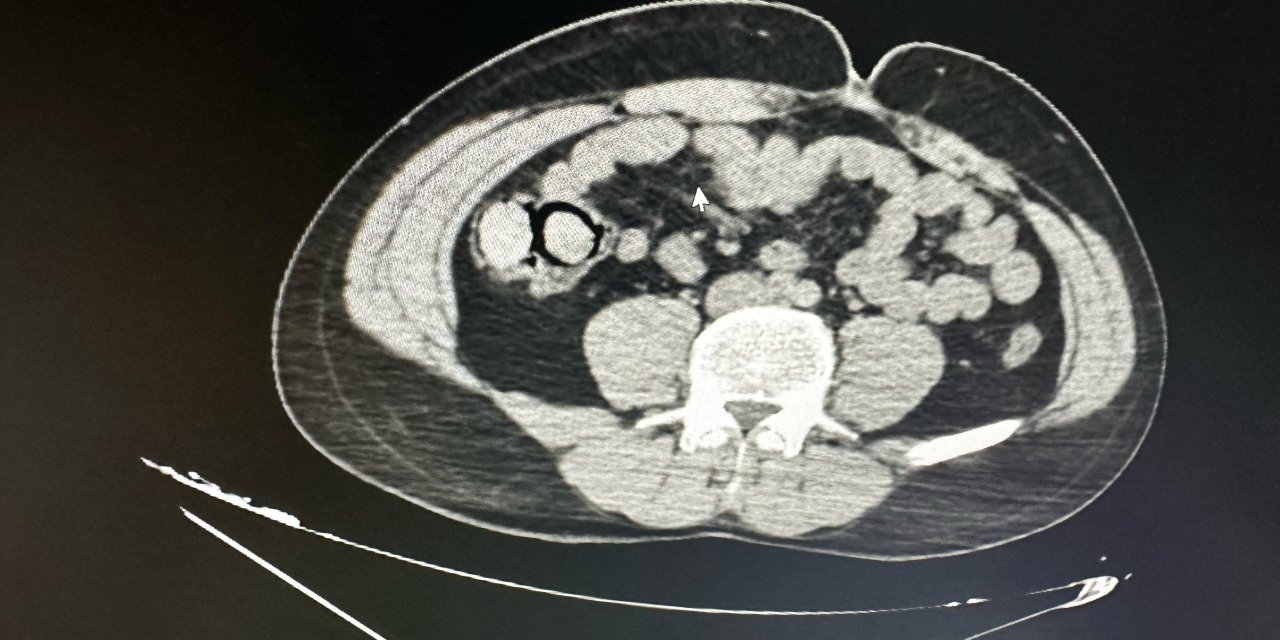 Bingöl’de akılalmaz uyuşturucu kaçakçılığı