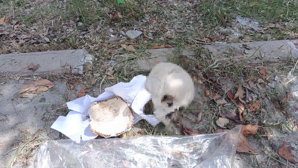 Çöpte bulunan kafatasının sırrı çözüldü