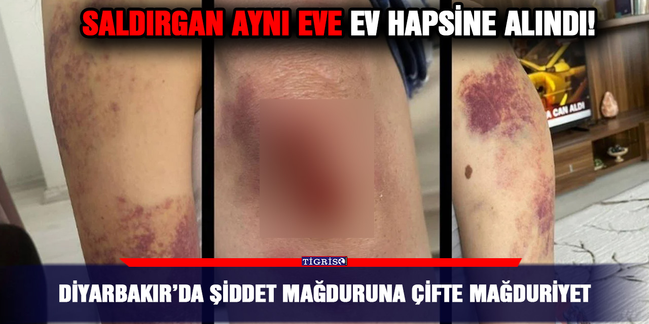 Diyarbakır’da şiddet mağduruna çifte mağduriyet