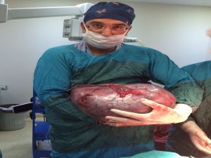 Tıp Literatüründe Nadir Görülen Bir Vaka