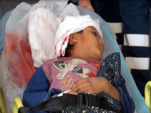 Yola fırlayan Suriyeli çocuğa otomobil çarptı