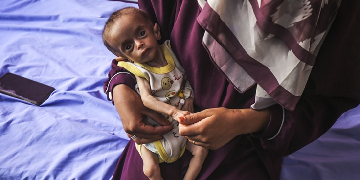 Gazze’de açlıktan ölenlerin sayısı 159’a ulaştı