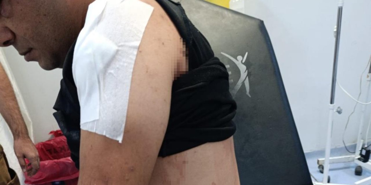 İş umuduyla gitti, saldırıya uğradı