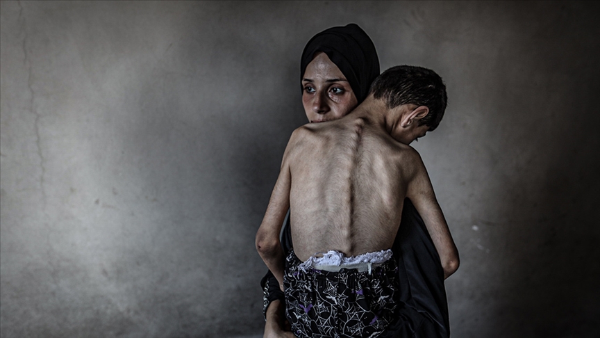Gazze'de 5 kişi daha açlıktan hayatını kaybetti