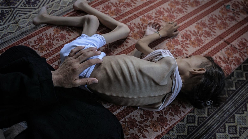 Gazze’de 7 Filistinli daha açlıktan hayatını kaybetti