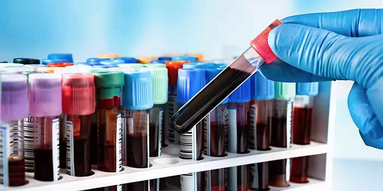 Bilim Kurgu gerçek oldu: Basit bir kan testiyle ömrünüz tahmin edilebilecek