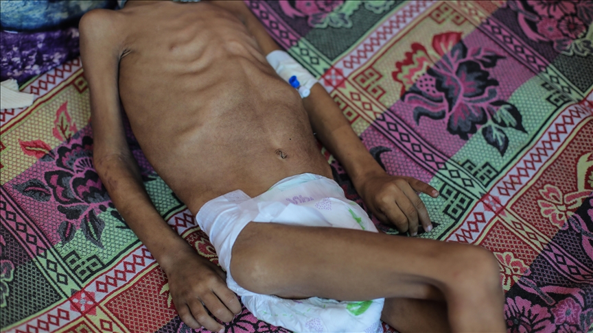 Gazze'de 13 kişi daha açlıktan hayatını kaybetti