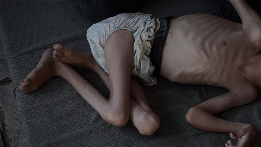 Gazze'de 6 kişi daha açlıktan hayatını kaybetti