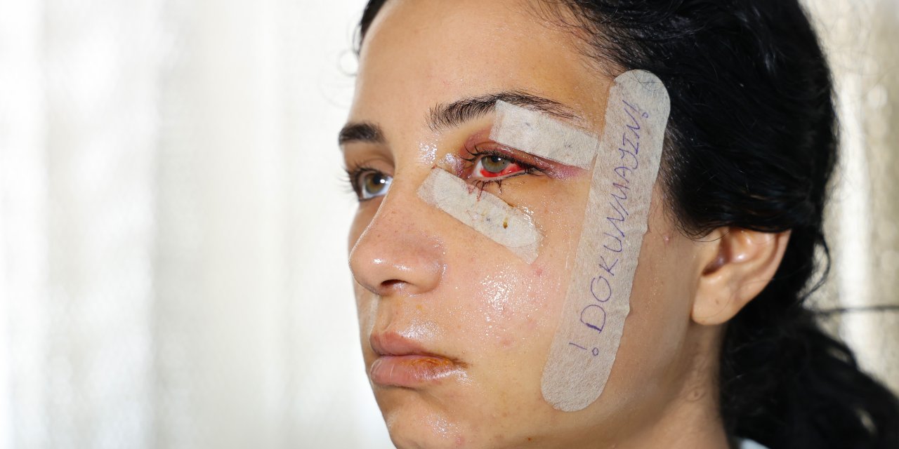 Eski eşine şiddet uygulayan şahıs tutuklandı