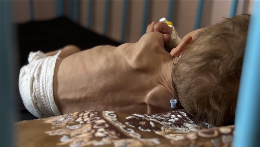 Gazze'de 5 kişi daha açlıktan hayatını kaybetti