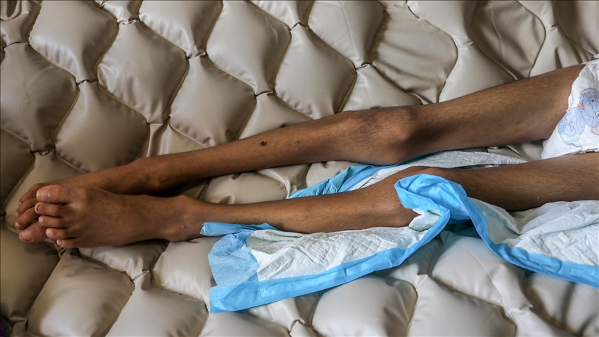 Gazze'de 6 kişi daha açlıktan hayatını kaybetti