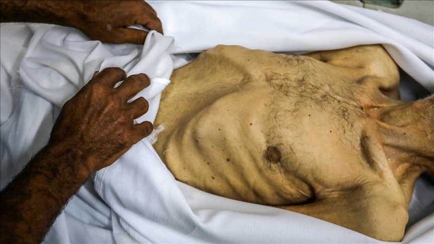 Gazze'de 7 kişi daha açlıktan hayatını kaybetti