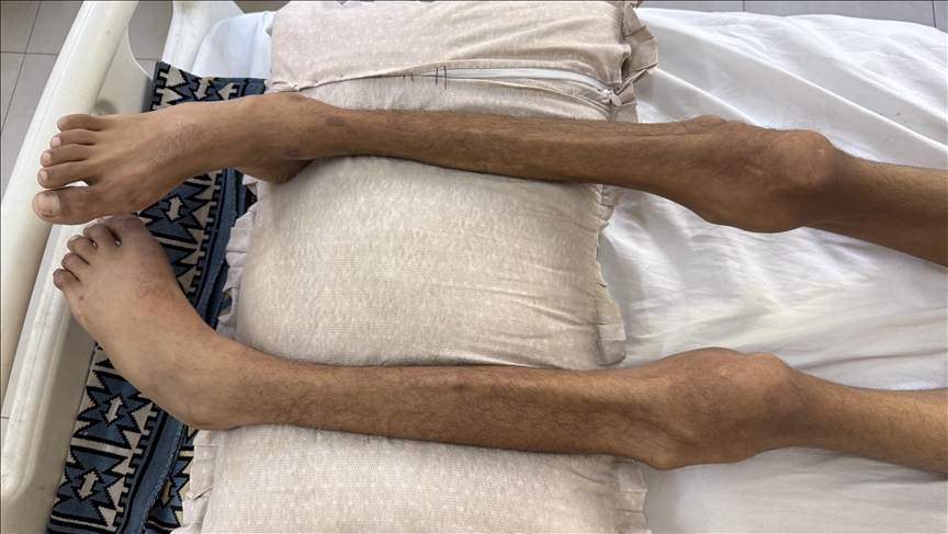 Gazze'de 2 kişi daha açlıktan hayatını kaybetti