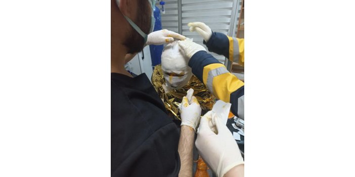 Kömür ocağında yangın: 2 yaralı