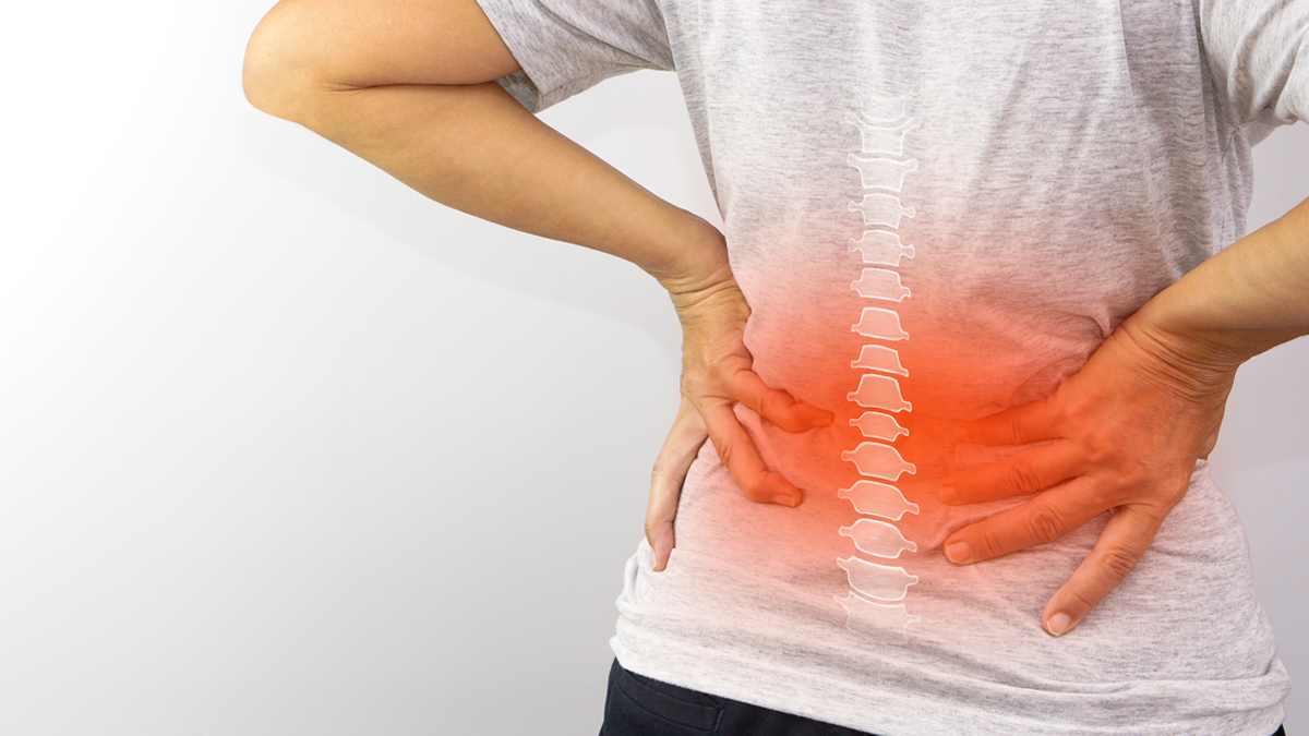 Bel kütletmek felce yol açabilir