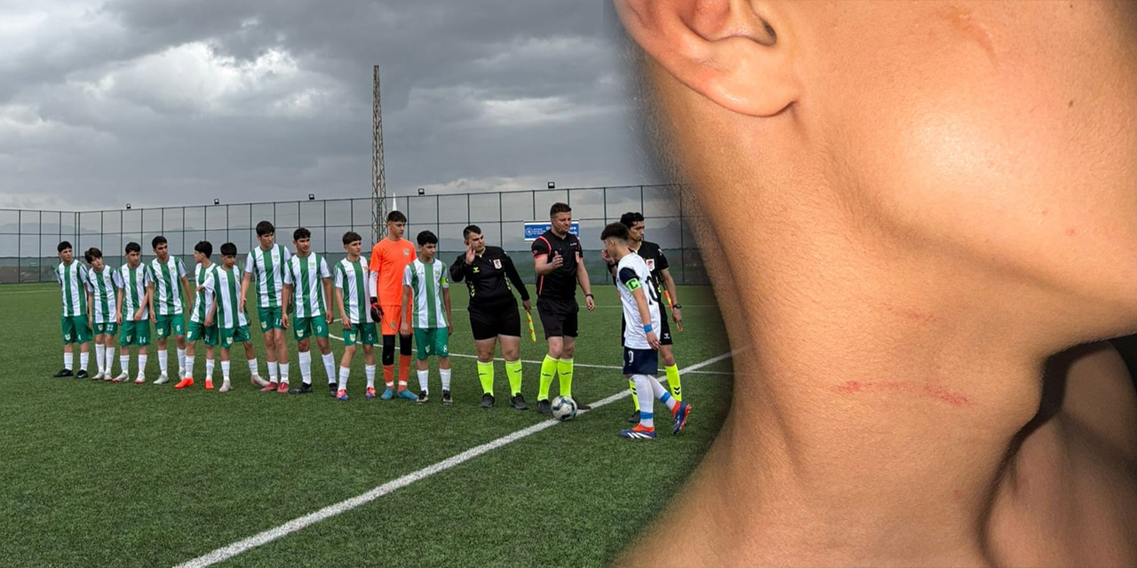 Diyarbakır Diyar İnter U14 takımına çirkin saldırı