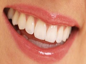 İmplant sonrası bekleme süresi