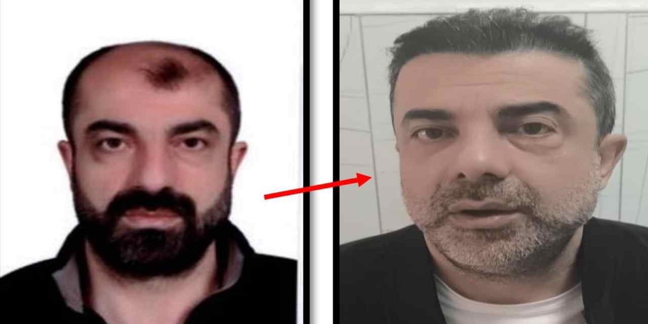 Cinayet zanlısı ameliyatla yüzünü değiştirip saklandı