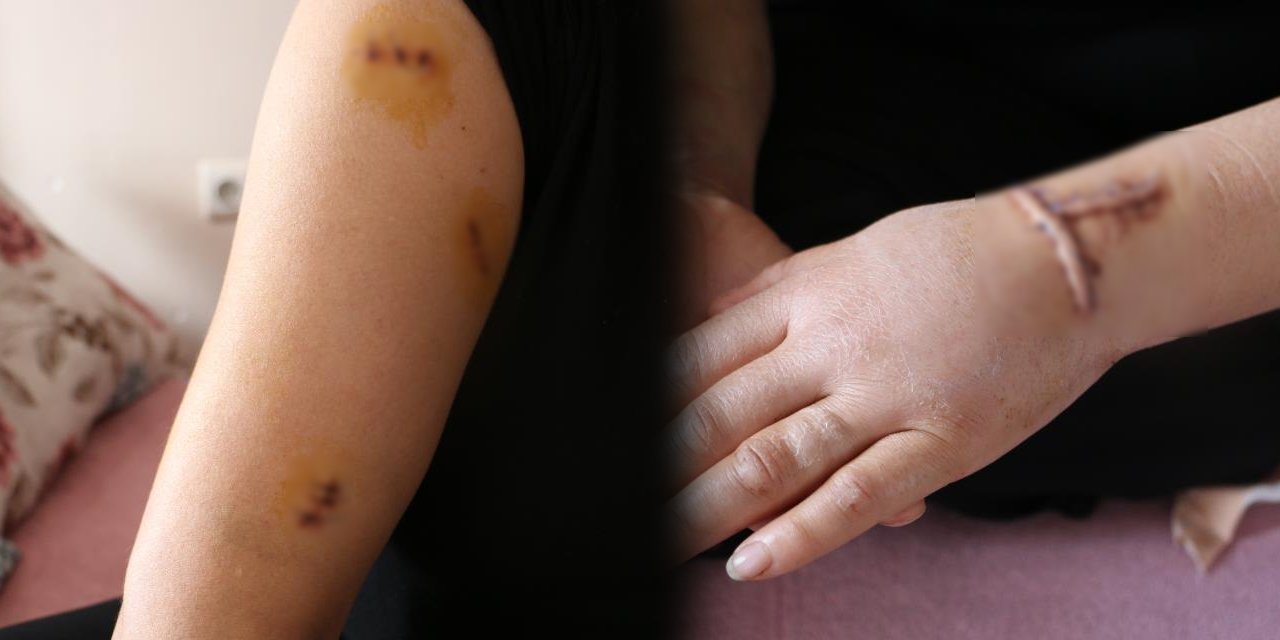 Diyarbakır’da erkek şiddeti: Eşini 30 yerinden bıçakladı