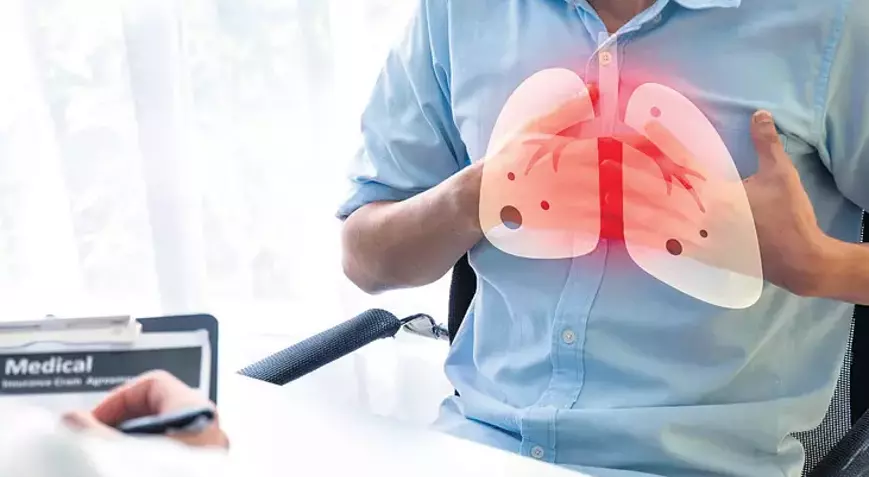 Akciğer kanserinde erken tanı hayat kurtarıyor