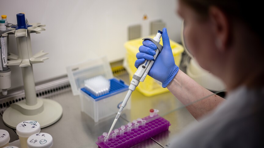 DSÖ, "hantavirüsü" yakın takibe aldı