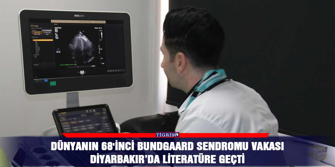 Dünyanın 68'inci Bundgaard Sendromu vakası Diyarbakır’da literatüre geçti
