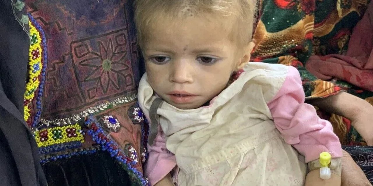 UNICEF: Afganistan'da 3,7 milyon çocuk yetersiz beslenmeden acı çekiyor