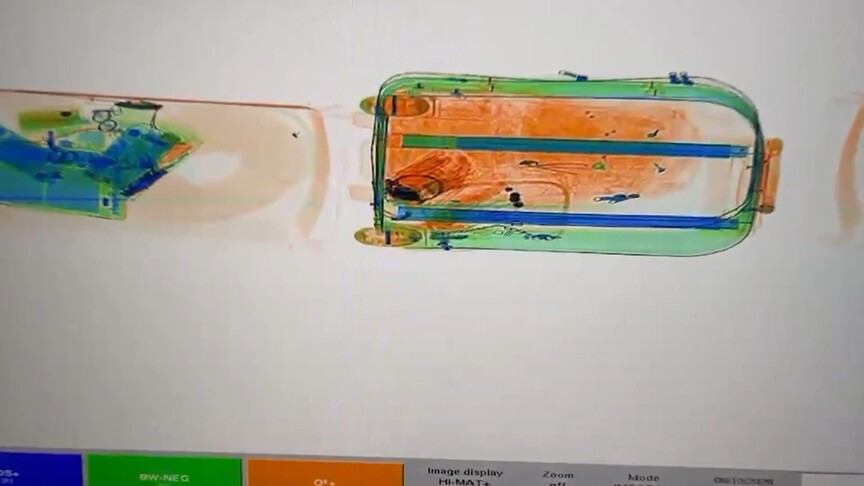 Yangın süsü verilen cinayet X-Ray görüntüleriyle aydınlatıldı