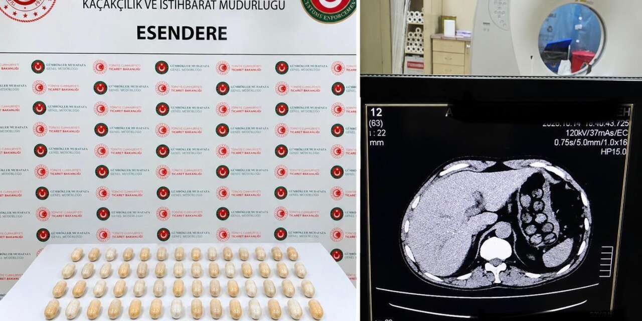 Hakkari’de uyuşturucu operasyonu: Biri midesinde, diğeri valizinde taşıdı
