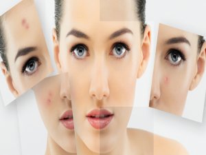 Cilt, koruyucu bir zarf değil!