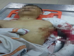 Yıldız patlama anında ağaçtan düştü