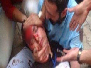 Diyarbakır'daki Patlamada Yaralanan Polise Halk Sahip Çıktı