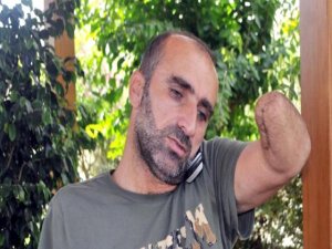 Kol nakli olup, hayata tutunacak