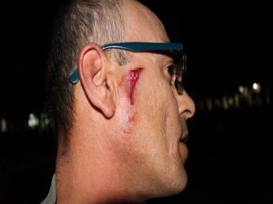 Özel harekat polisleri gazetecilere saldırdı