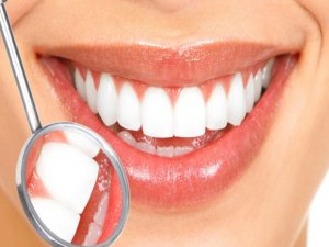 Diş etleri neden kanar