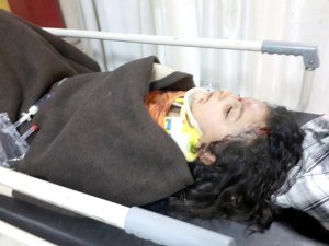 Kurbanlık koç beş yaşındaki kızı hastanelik etti