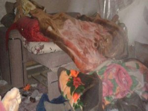 Cizre’deki yaralıların görüntüleri paylaşıldı