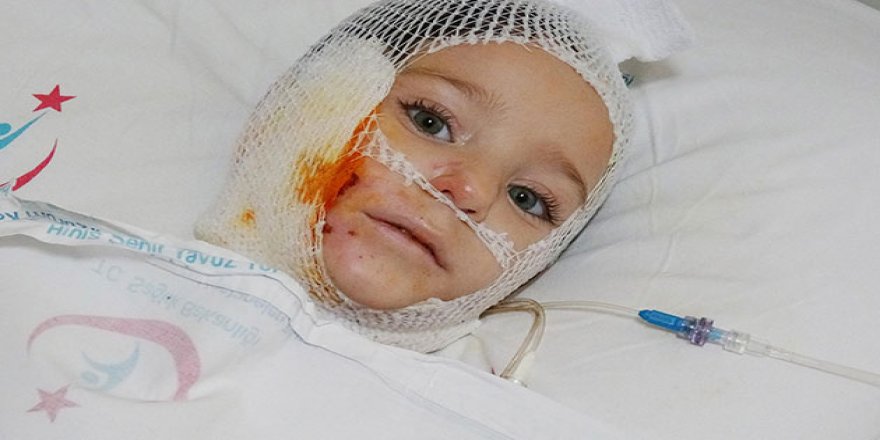 Kibritle oynarken kendini yaktı