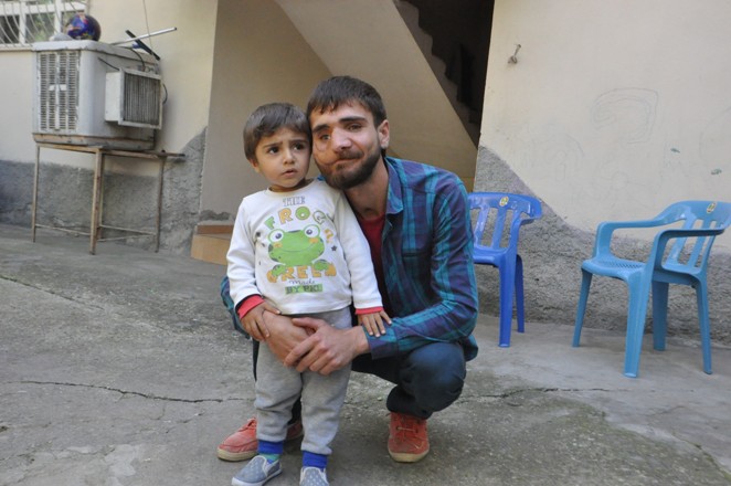 38 kez ameliyat oldu, yüzü düzelmedi 