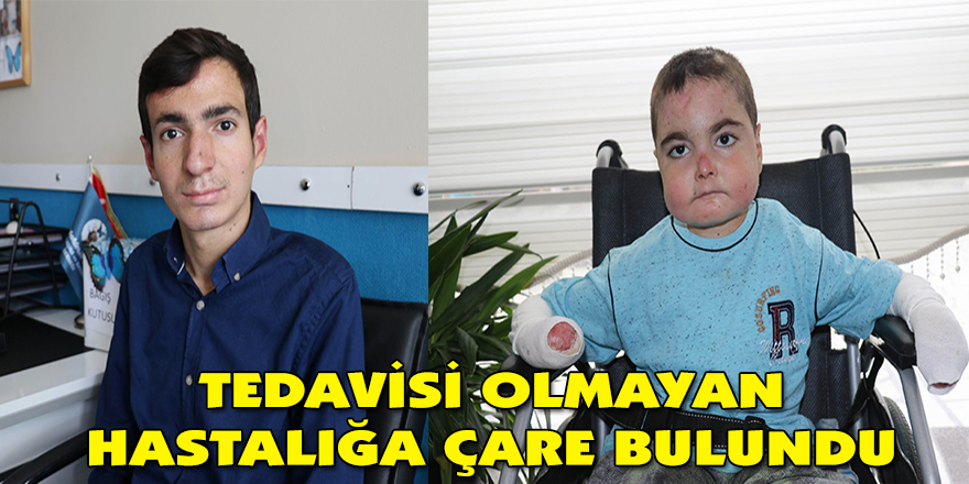 Tedavisi olmayan hastalığa çare bulundu