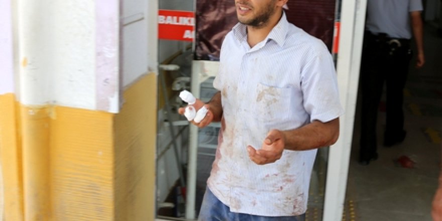 Acemi kasap parmaklarını kesti