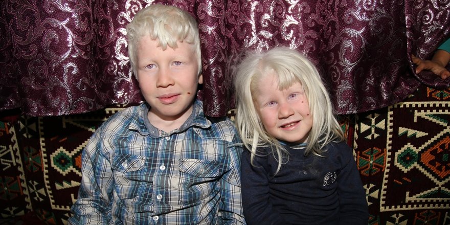 "Beyaz melekler" güneş kentinde güneşe hasret yaşıyor