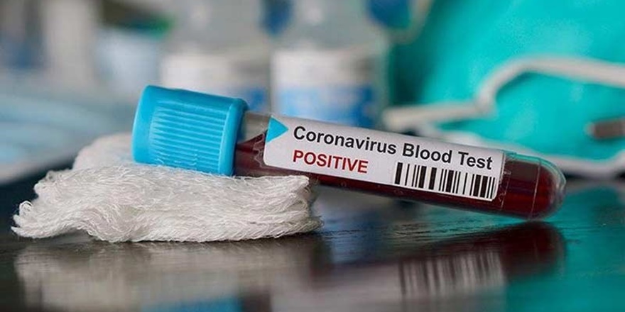 "Worldometer" dünyada koronavirüs nedeniyle ölenlerin sayısını açıkladı